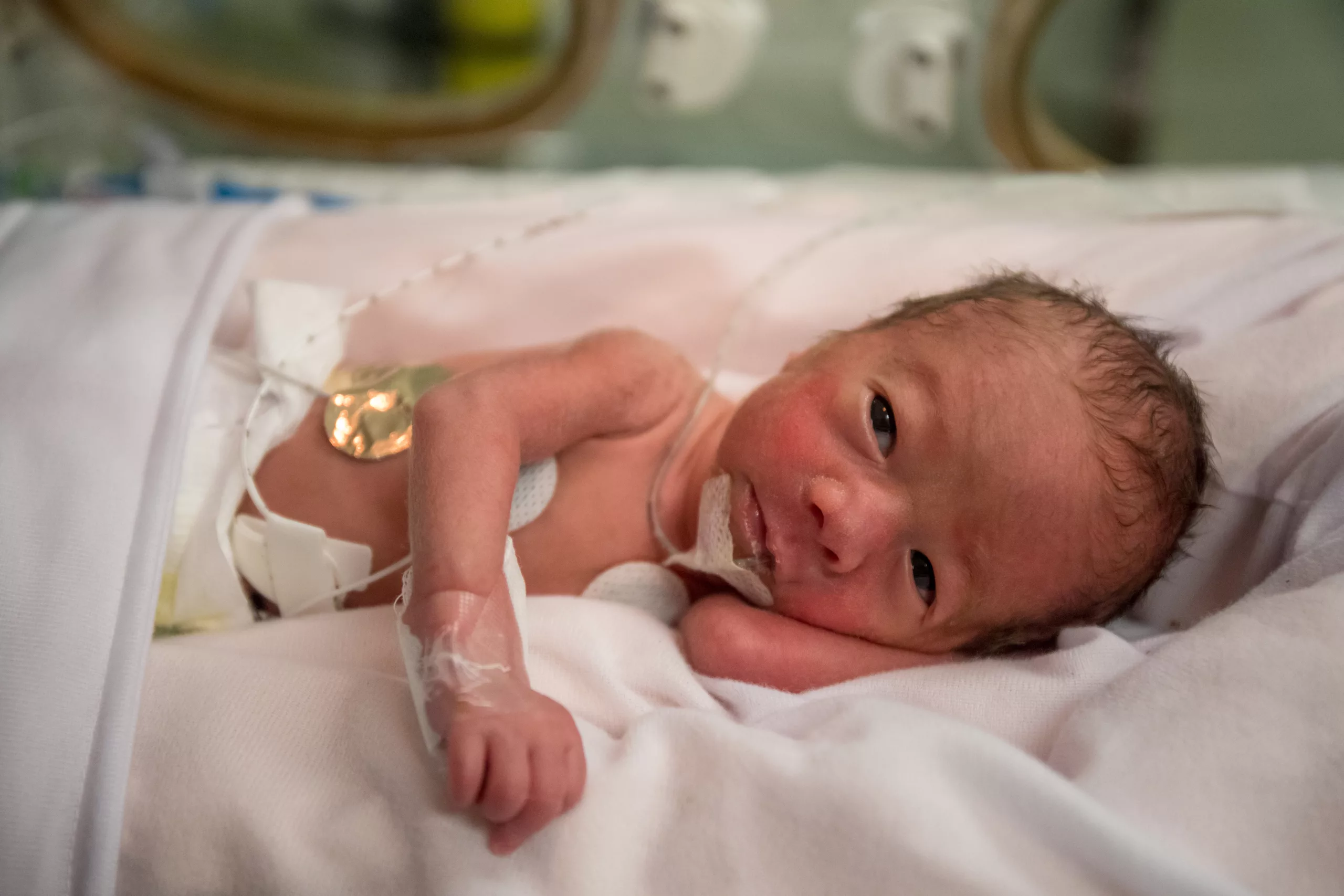 Whats The Connection Between Phthalates And Preterm Birth