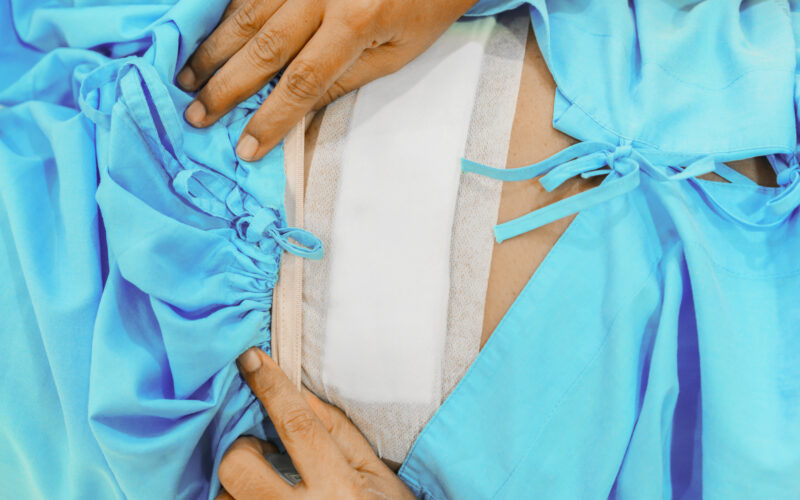 hysterectomy, risks, side effects, ovaries