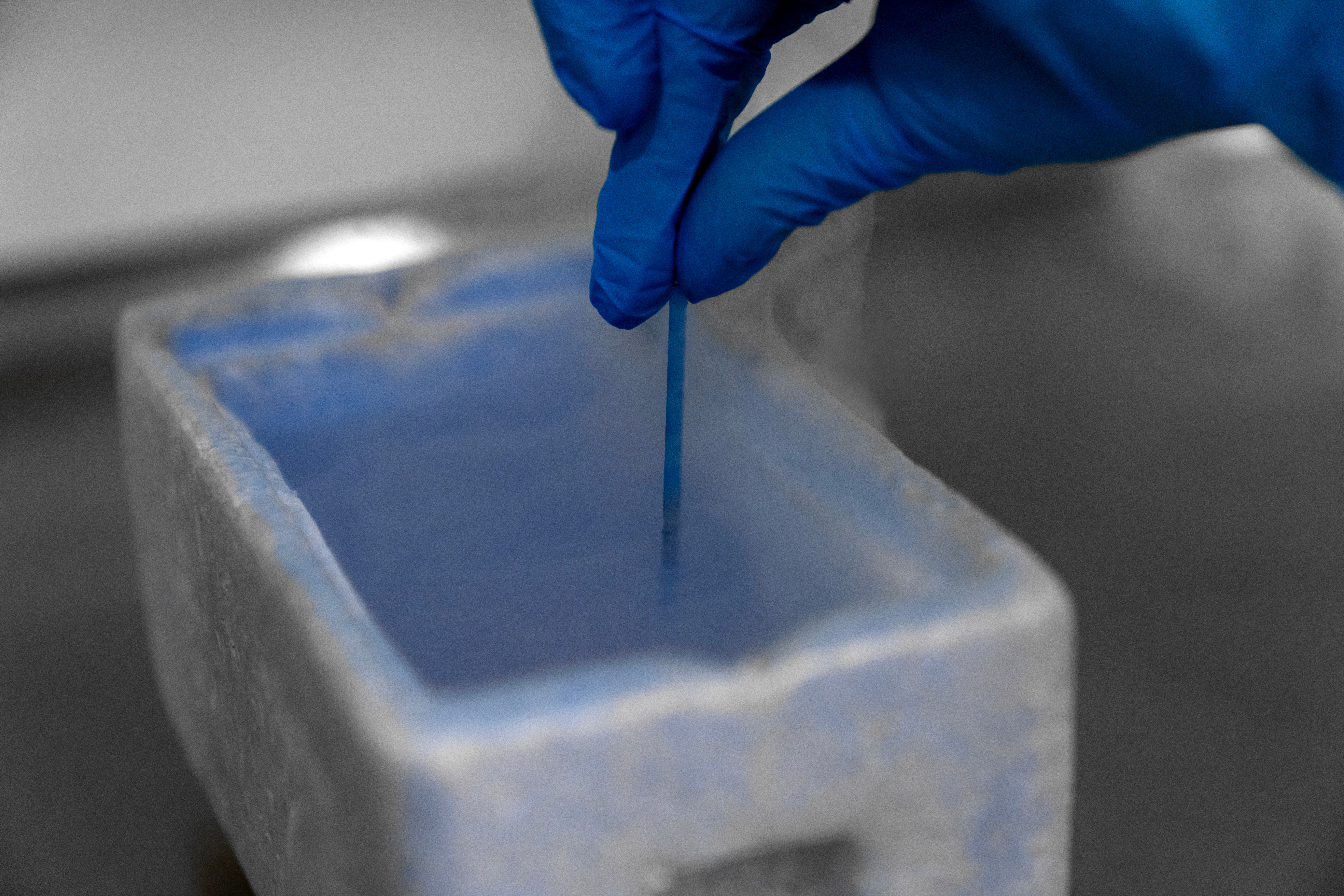 egg retrieval and ivf, egg freezing, in vitro fertilization