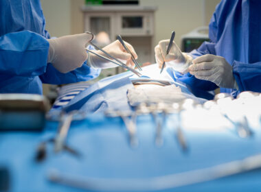 chirurgie de l'endométriose, chirurgie de l'endo, chirurgie de l'endo, chirurgie d'excision de l'endométriose, chirurgie d'ablation de l'endométriose, excision vs ablation de l'endo