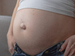 pregnancy and hernia, umbilical hernia, c-section