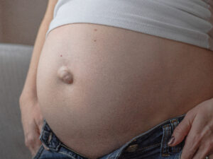 беременность и грыжа, пупочная грыжа, кесарево сечение