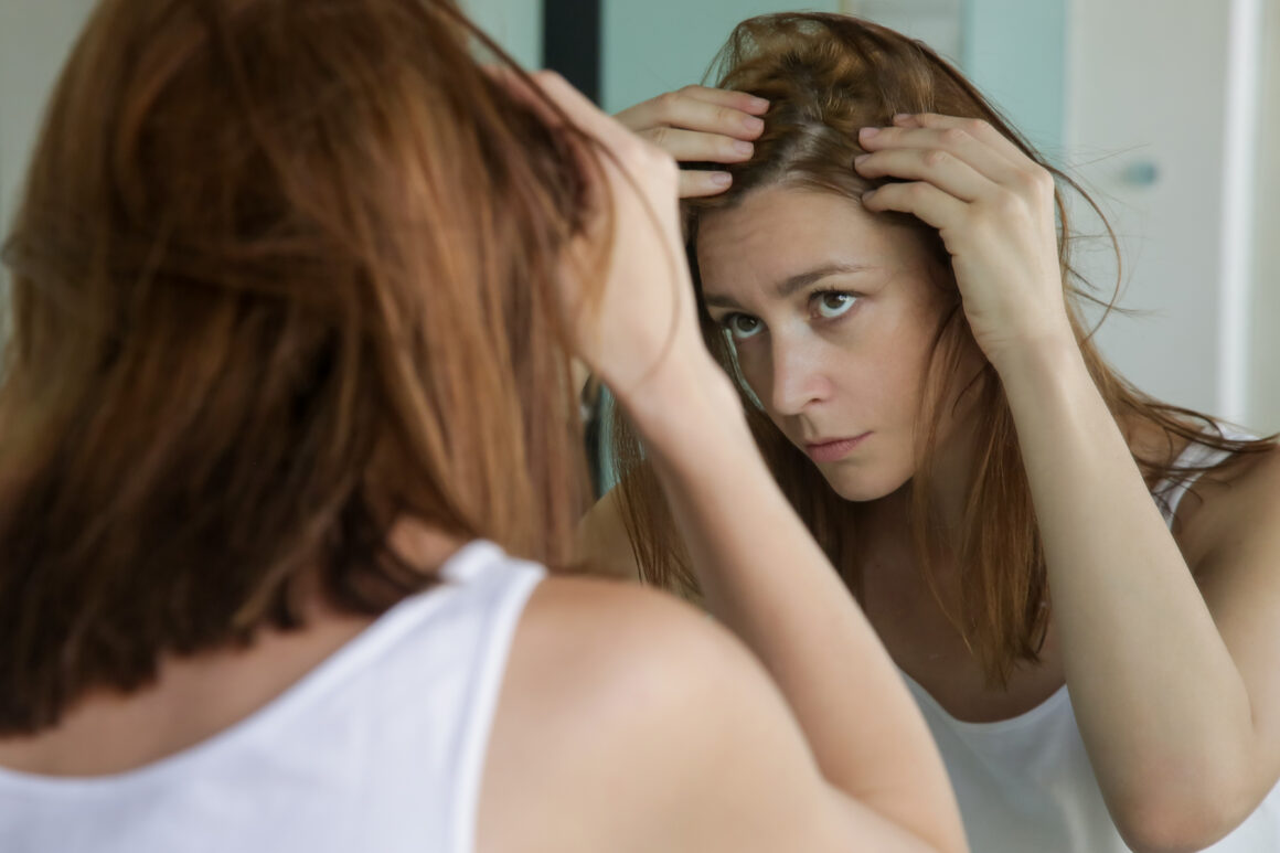 hormonal hair loss, hair loss, PMOS, perimenopause