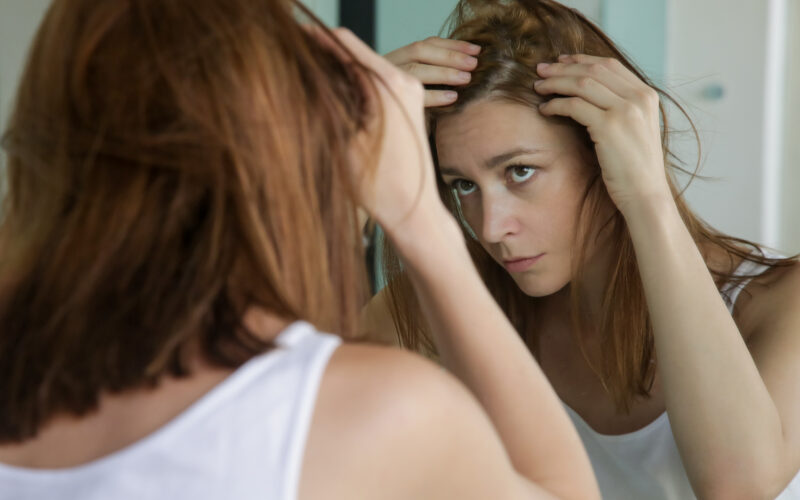 hormonal hair loss, hair loss, PMOS, perimenopause