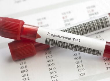 low progesterone, progesterone testing, PCOS, anovulation, luteal phase defect, luteal phase deficiency, progesterone