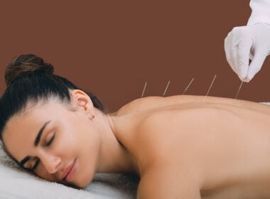 acupuncture period pain, acupuncture endometriosis period pain, acupuncture endometriosis pain, acupuncture endometriosis, holistic treatment endometriosis pain, tcm endometriosis pain