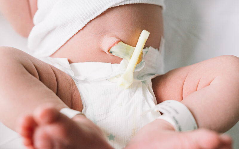 delayed cord clamping