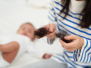 postpartum hair loss
