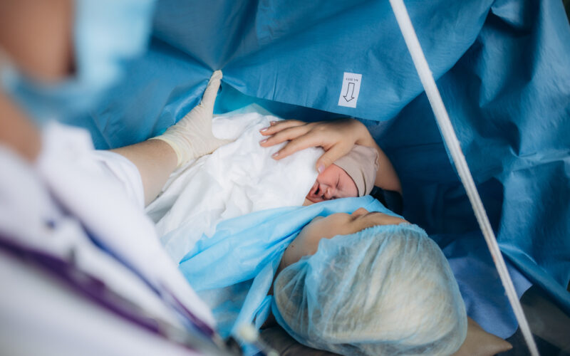 C section long term effects, Cesarean section long term effects, Cesarean sections effects baby, C sections effects baby, C section long term impact, C section health risks baby, C section obesity, C section atopy, C section hay fever, C section asthma,