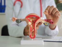 fallopian tube removal, salpingectomy, salpingectomy ovarian cancer, salpingectomy oophorectomy, salpingectomy breast cancer, what is a salpingectomy, salpingectomy ectopic pregnancy,