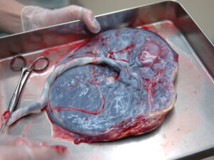 placenta function