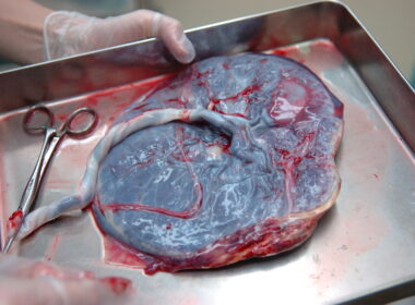 placenta function
